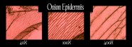 Onion Cells With Iodine